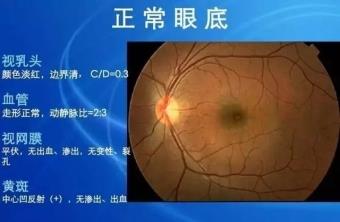 下载 (1)