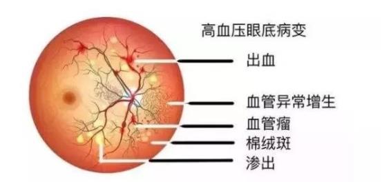 下载 (2)